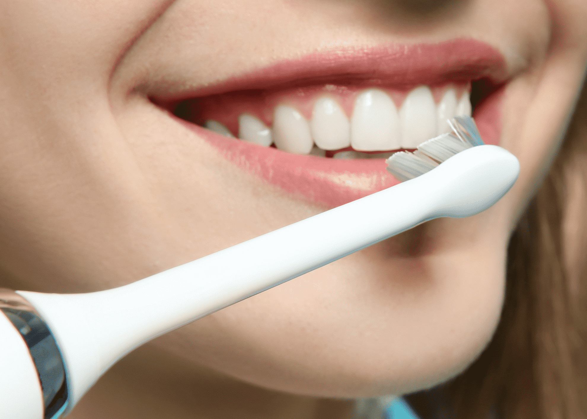 כיצד לשמור על ציפוי שיניים