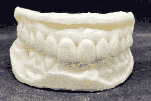 מודל שיניים תלת-ממדית